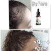 Ajumah Beauty Hot Hair Growth Oil 100ml - Afbeelding 4